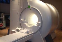 How Much Does Ct Scan Cost Without Insurance